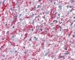 CNR2 / CB2 Antibody (Internal)